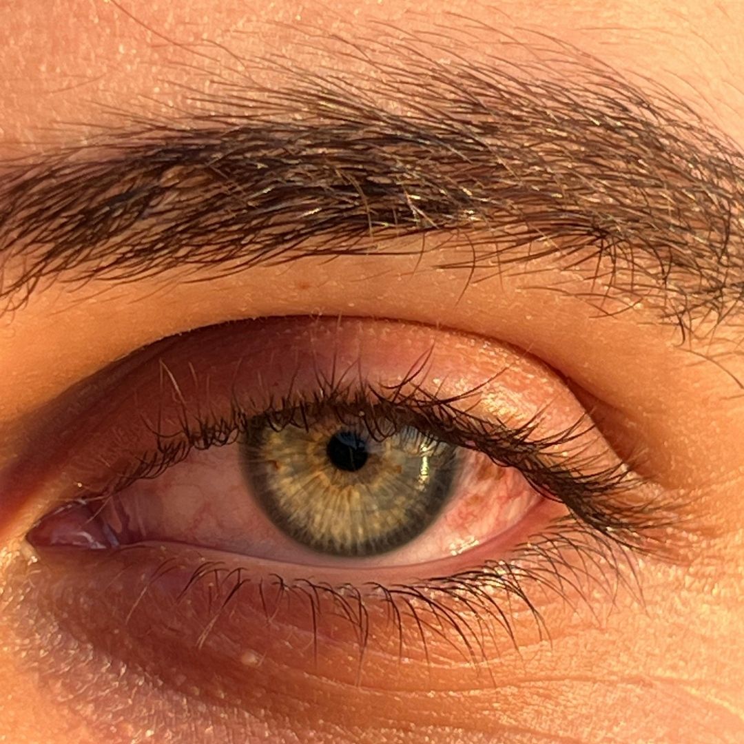 close up of a red eye